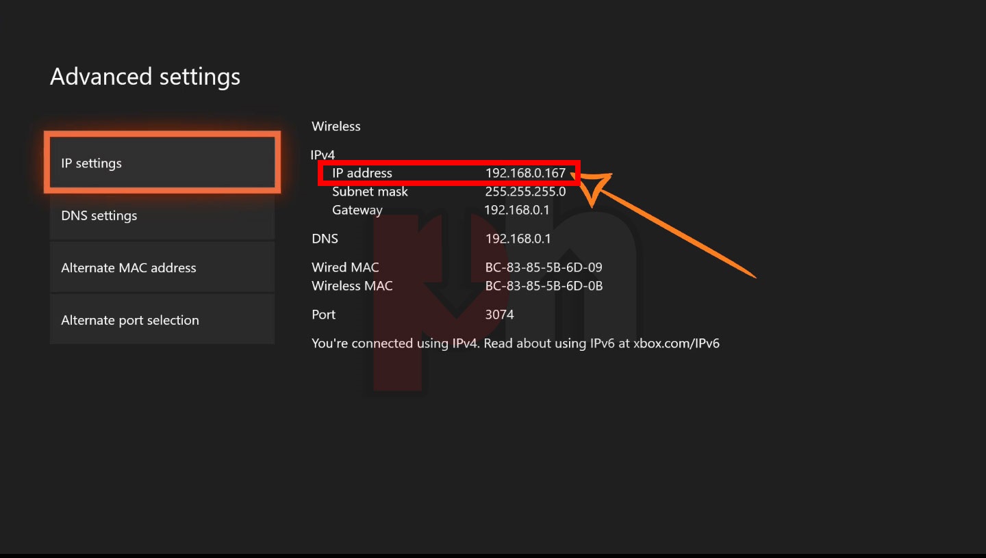 manually assign ip address xbox one