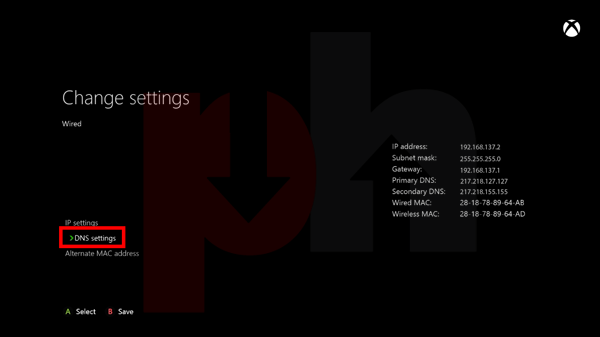 Entering Settings on Xbox one/Xbox 360 game console